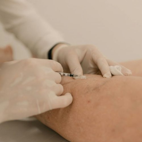 Unidade vai oferecer consultas de cirurgia vascular e angiologia, exames e tratamento de varizes por escleroterapia Foto: Divulgação