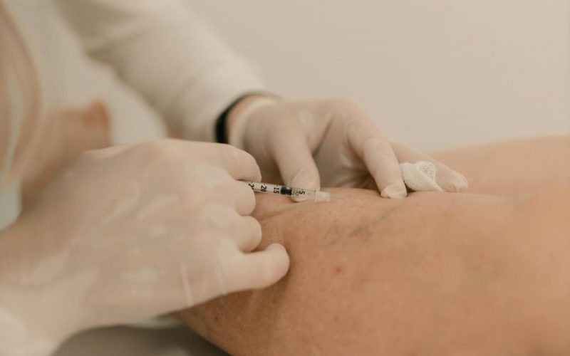 Unidade vai oferecer consultas de cirurgia vascular e angiologia, exames e tratamento de varizes por escleroterapia Foto: Divulgação